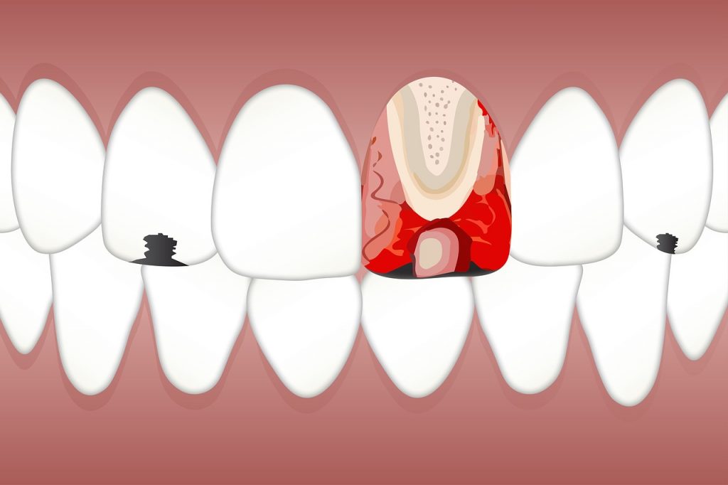 cấu tạo răng