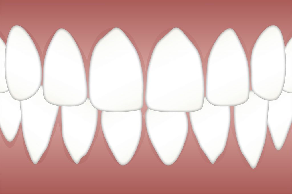 benh-nha-chu-va-nguy-co-ung-thu bệnh nha chu và nguy cơ gây ung thư